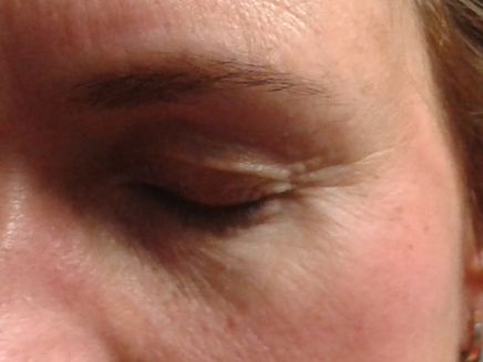 Revitalash serum